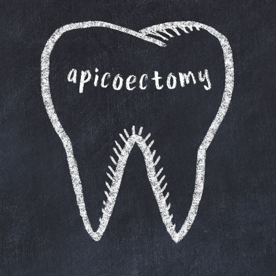 apicoectomy sterling