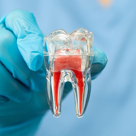 root canal sterling root canal near me